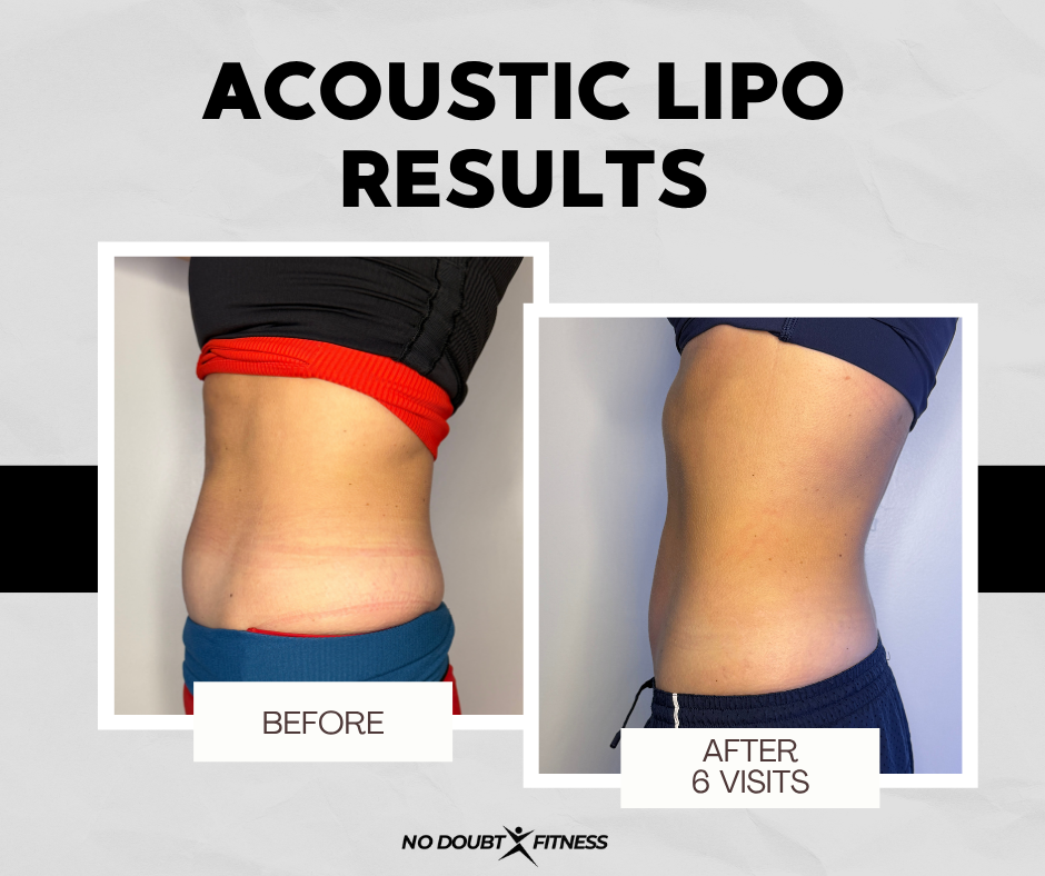 Before and after body sculpting in Muscle Shoals